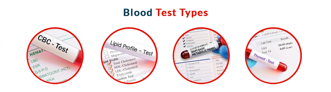 Different Kind Blood Tests